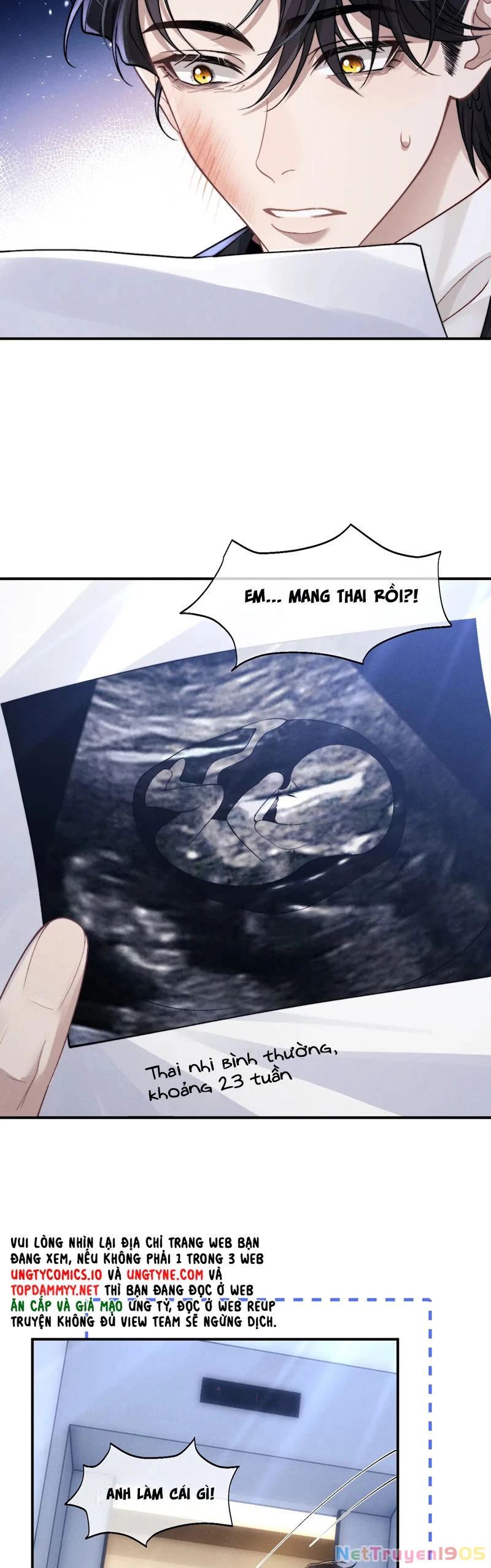 Chấp Sự Thỏ Cụp Tai Chapter 130 - 19