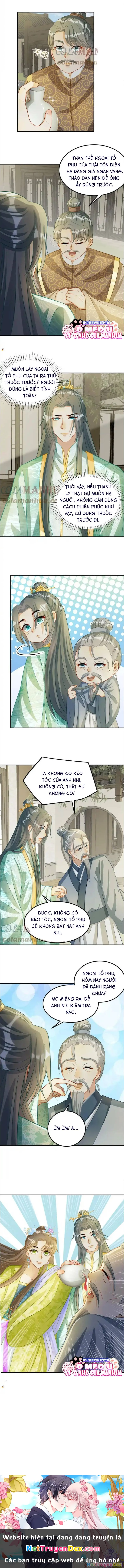 Thiên Tài Manh Bảo , Mẫu Thân Nghịch Thiên Bật Hack Rồi! Chapter  18 - 4