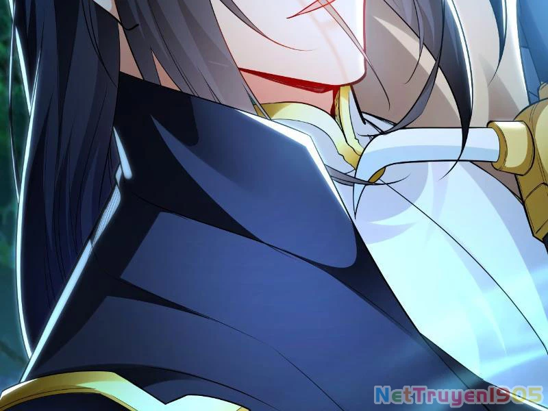 Ta Có Trăm Vạn Tốc Độ Đánh Chapter 25 - 87