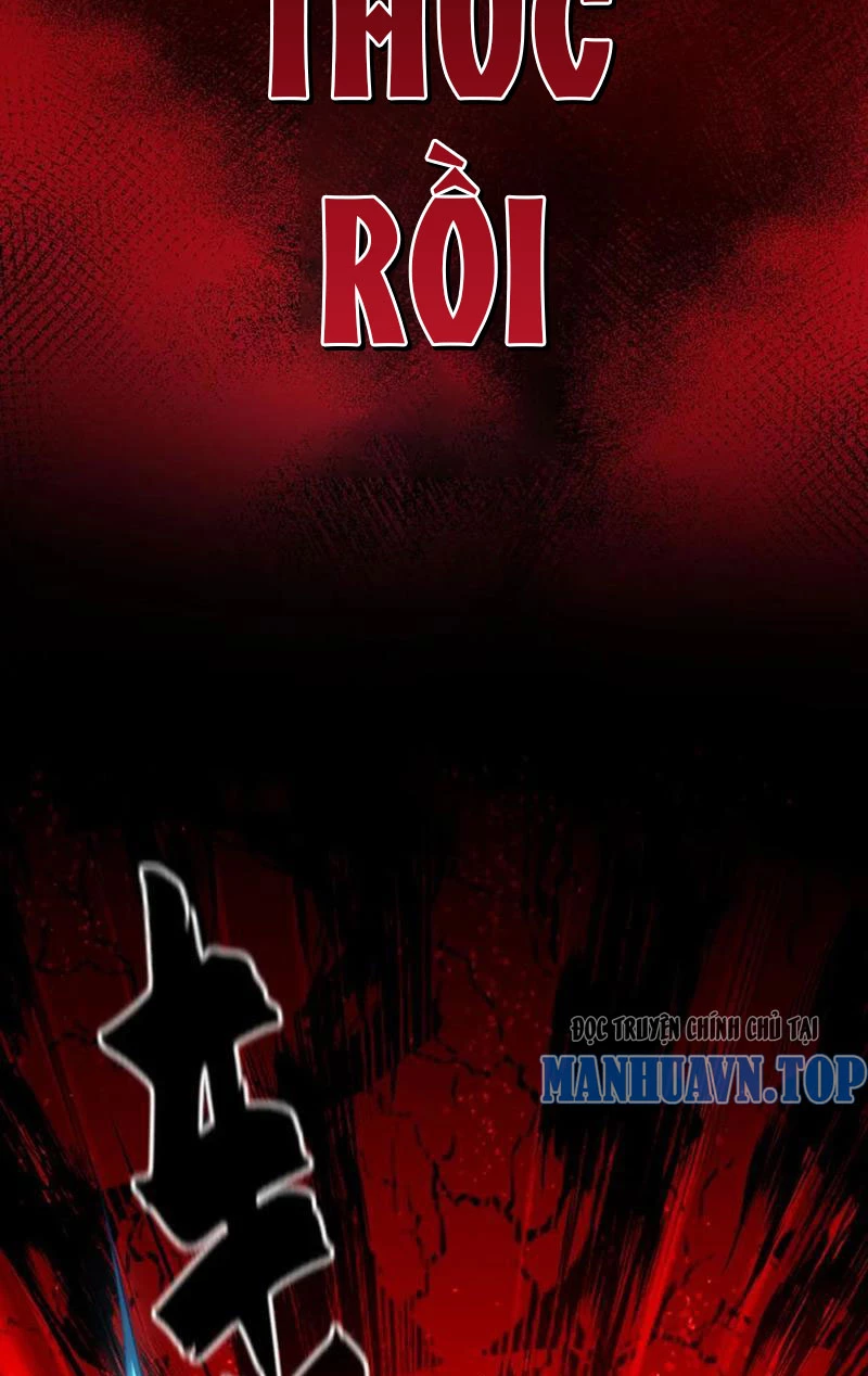 Ta Có Trăm Vạn Tốc Độ Đánh Chapter 31 - 17