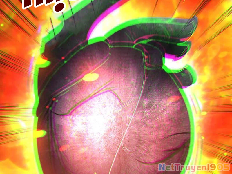 Ta Có Trăm Vạn Tốc Độ Đánh Chapter 59 - 66