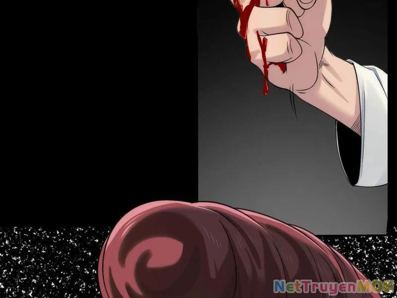 Trước mặt bệnh tâm thần, quỷ dị chẳng là gì cả Chapter 73 - 11