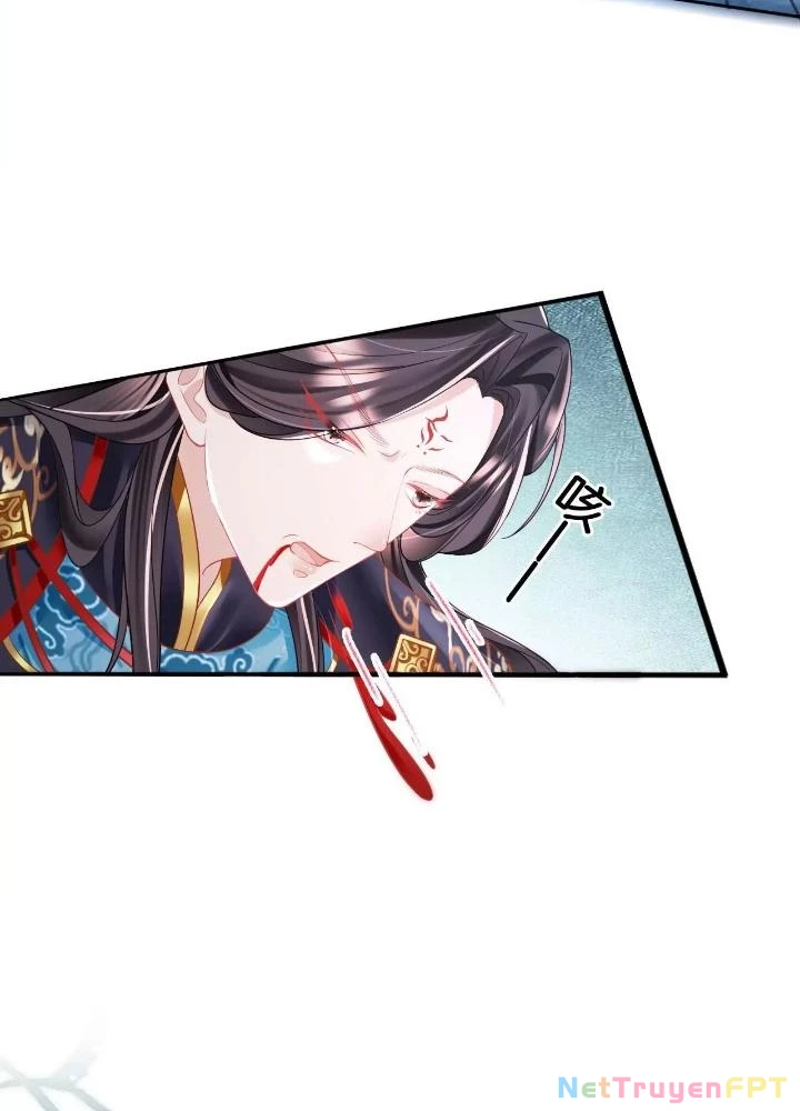 Thiên Hạ Vô Song Chapter 75 - 45