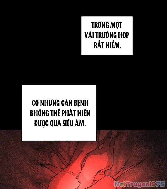 Kẻ Chôn Cất Quái Vật Chapter 1 - 79