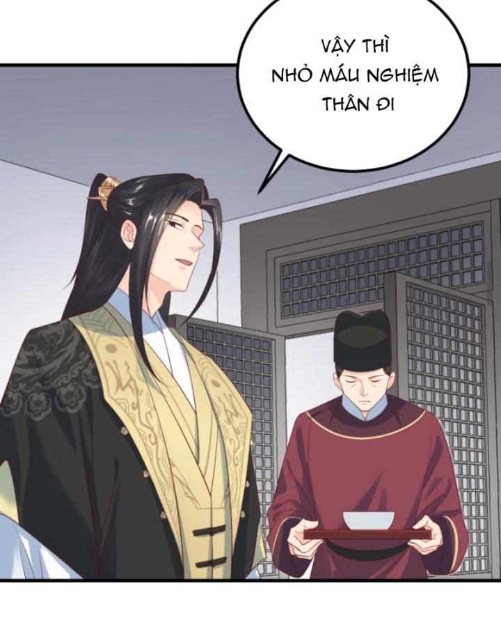 Bắt Ta Làm Cung Nữ? Ta Liền Cho Bạo Quân Quỳ Ván Giặt Đồ!!!! Chapter 303 - 11