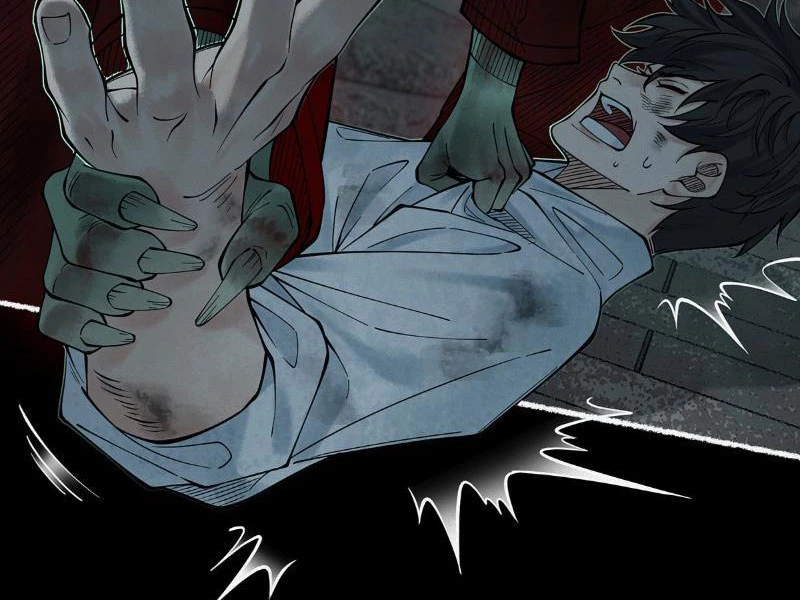 Thu Thi Nhân: Mở Đầu Bằng Việc Giải Phẫu Bạn Gái Cũ Chapter 4 - 25