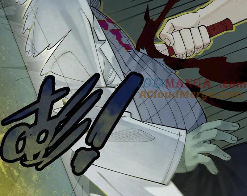 Thu Thi Nhân: Mở Đầu Bằng Việc Giải Phẫu Bạn Gái Cũ Chapter 14 - 24