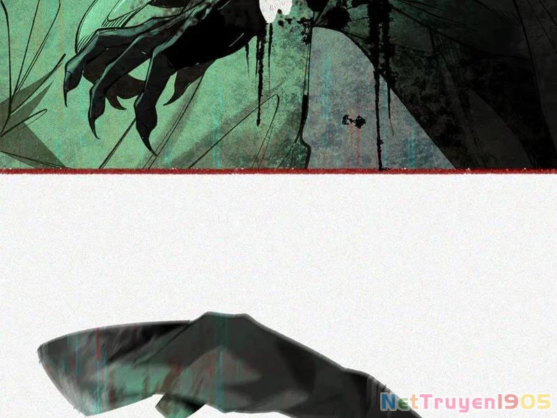 Thu Thi Nhân: Mở Đầu Bằng Việc Giải Phẫu Bạn Gái Cũ Chapter 21 - 5