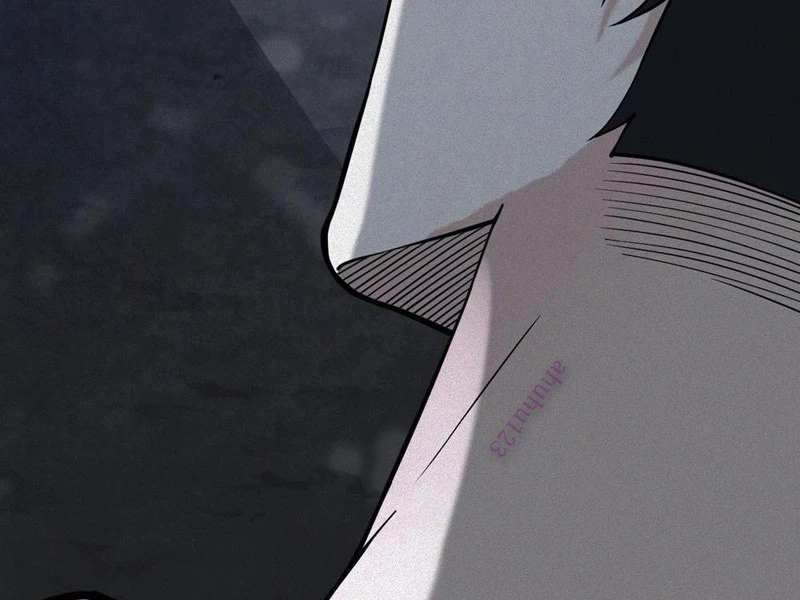 Thu Thi Nhân: Mở Đầu Bằng Việc Giải Phẫu Bạn Gái Cũ Chapter 23 - 98