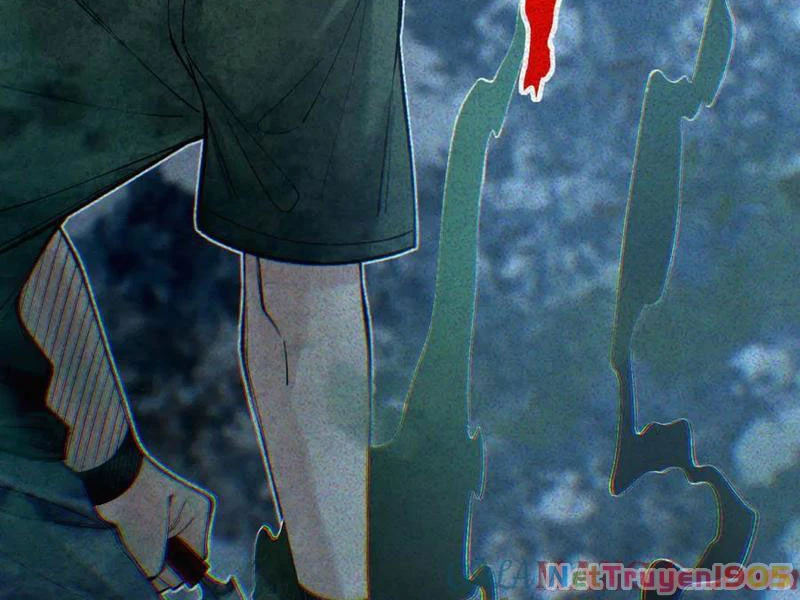 Thu Thi Nhân: Mở Đầu Bằng Việc Giải Phẫu Bạn Gái Cũ Chapter 33 - 59