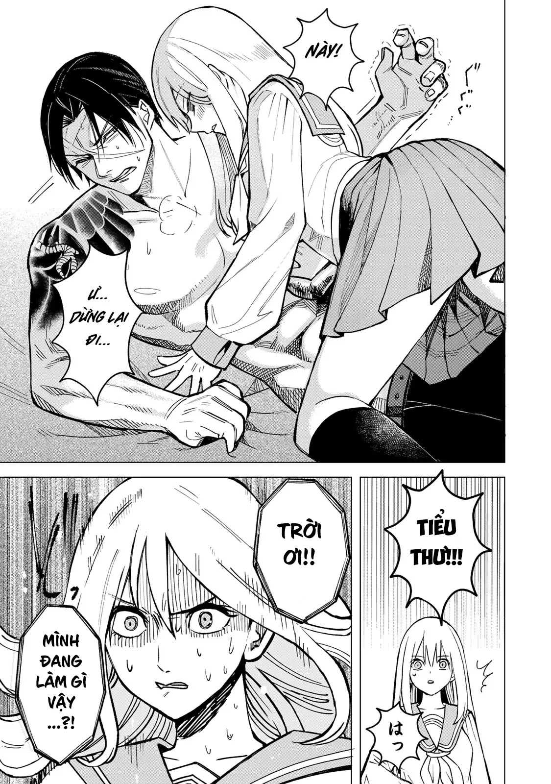 Wound & Bandage Chapter 1 - 27