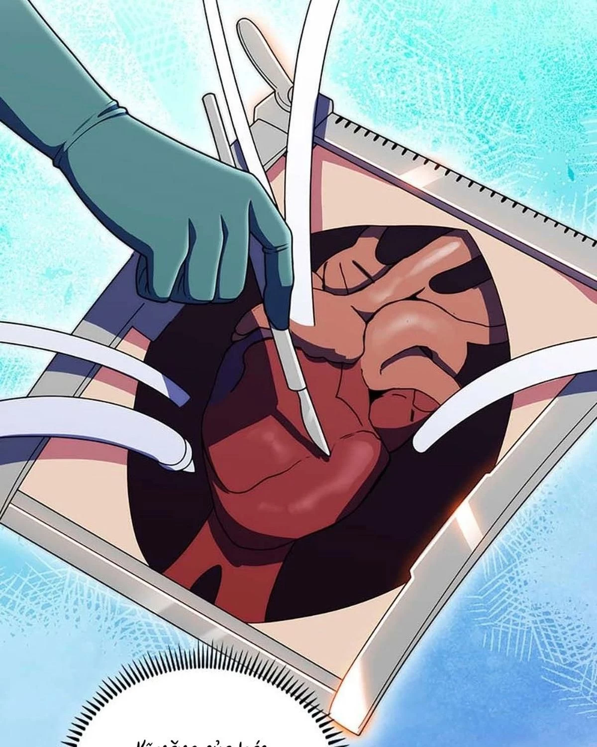 Bác Sĩ Thăng Cấp Chapter 106 - 30