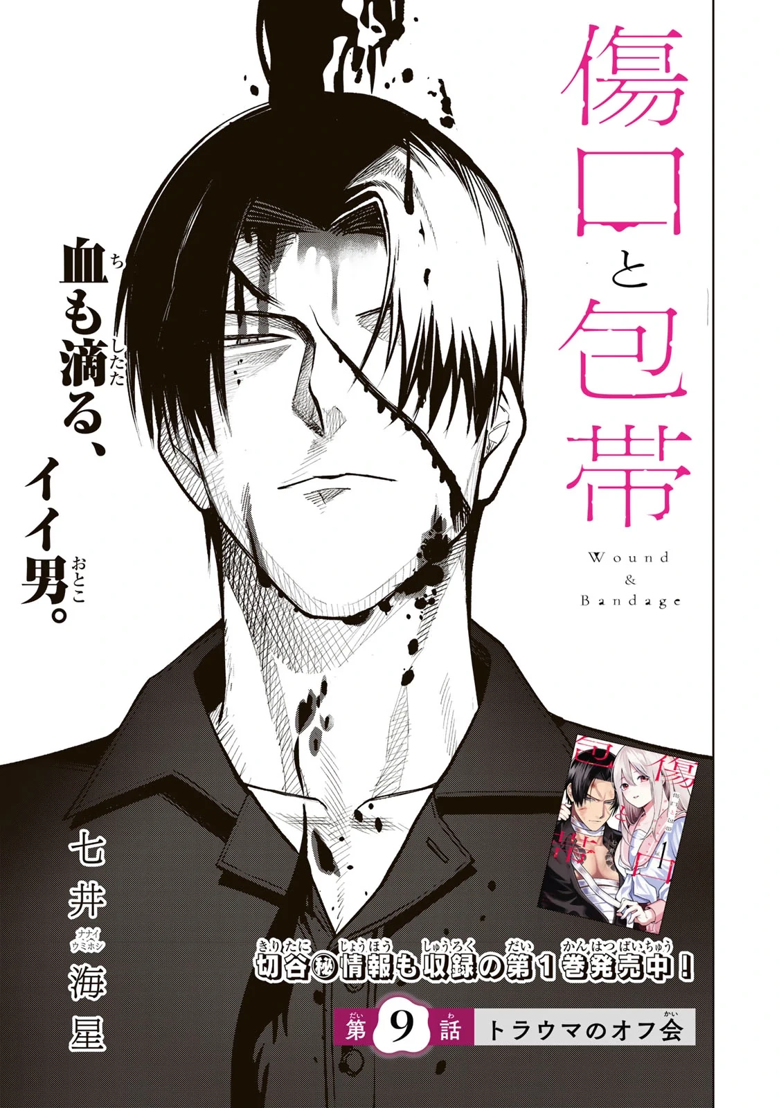 Wound & Bandage Chapter 9 - 1