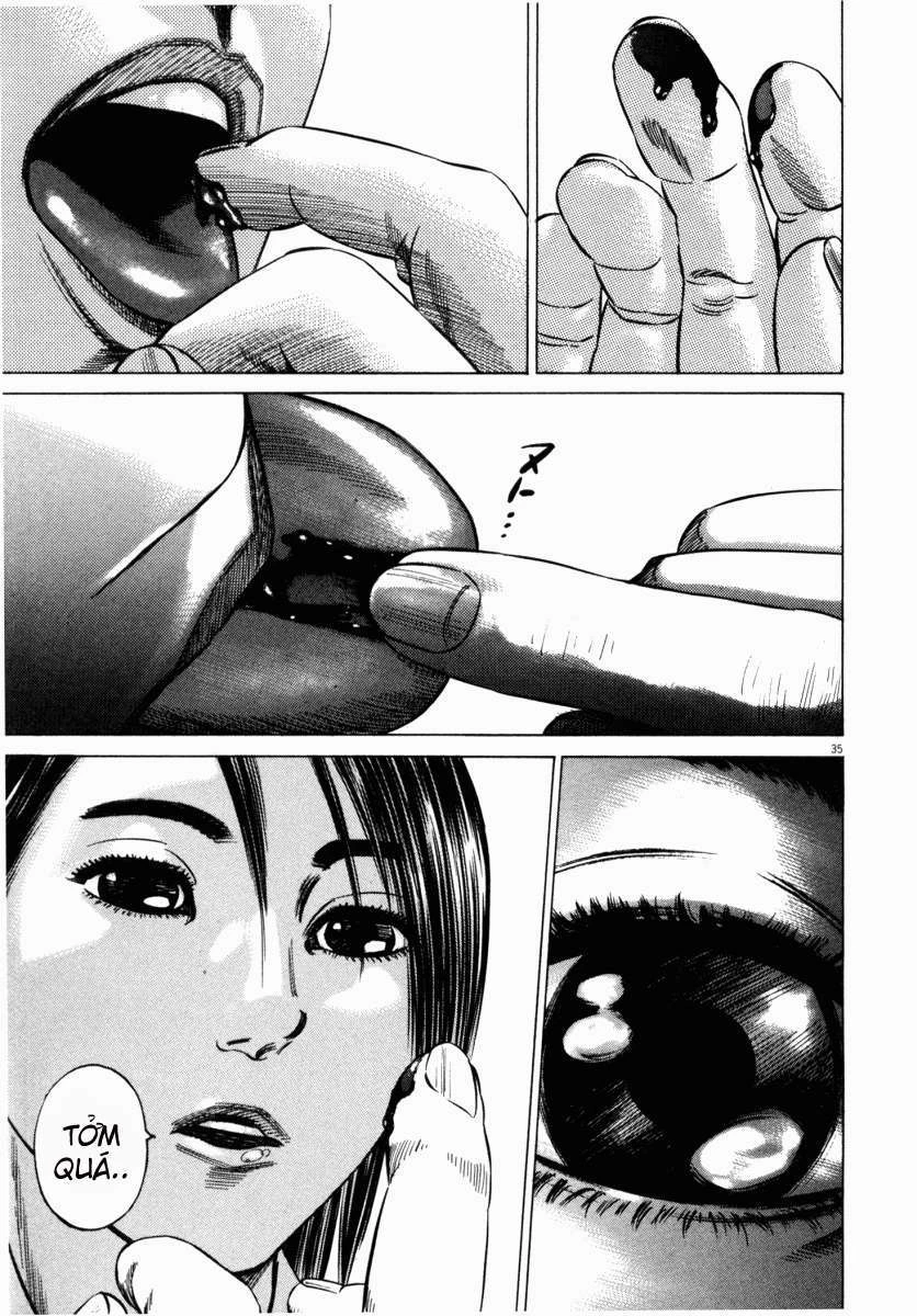 Homunculus Chapter 42 - 39