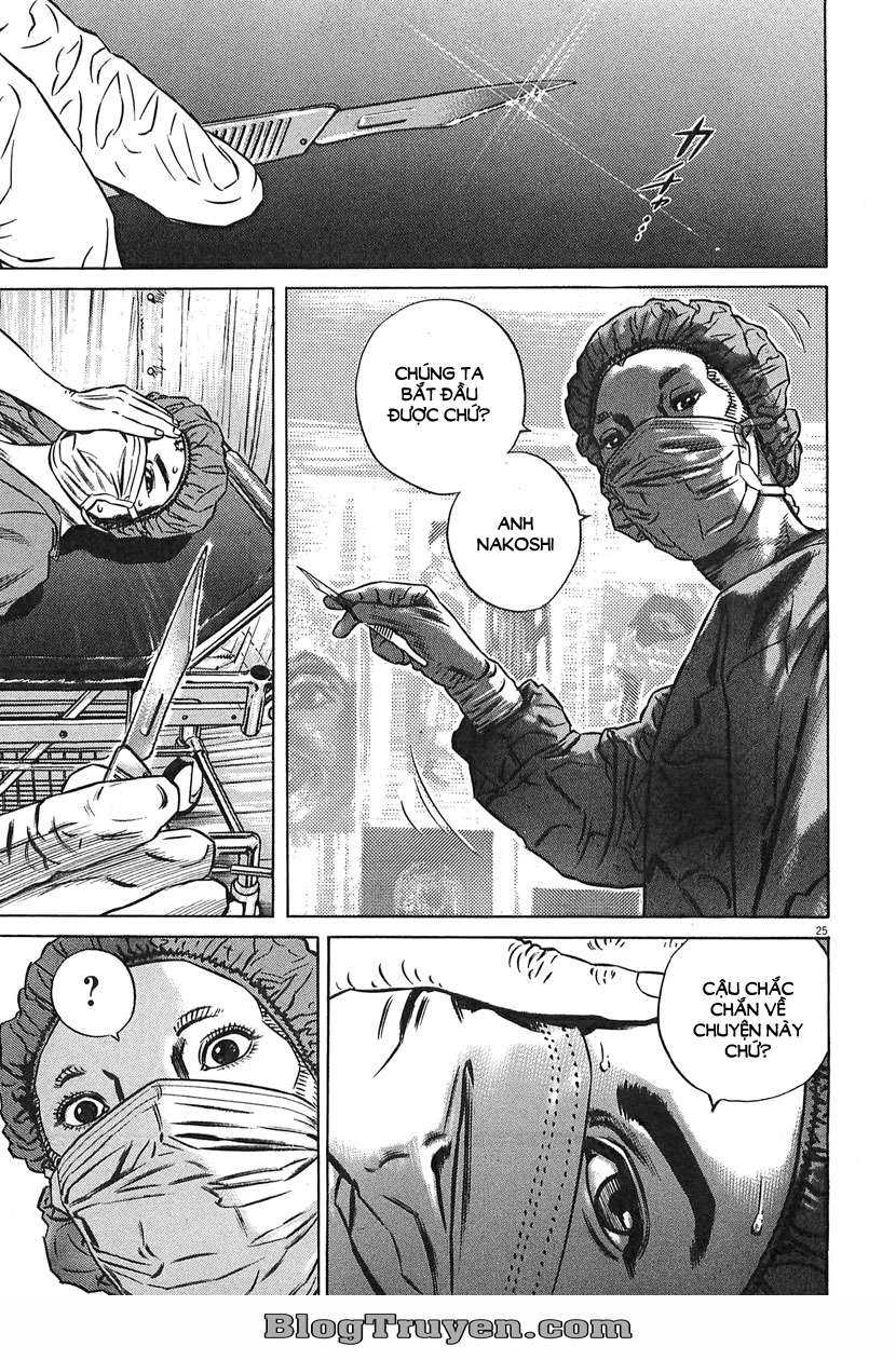 Homunculus Chapter 63 - 11