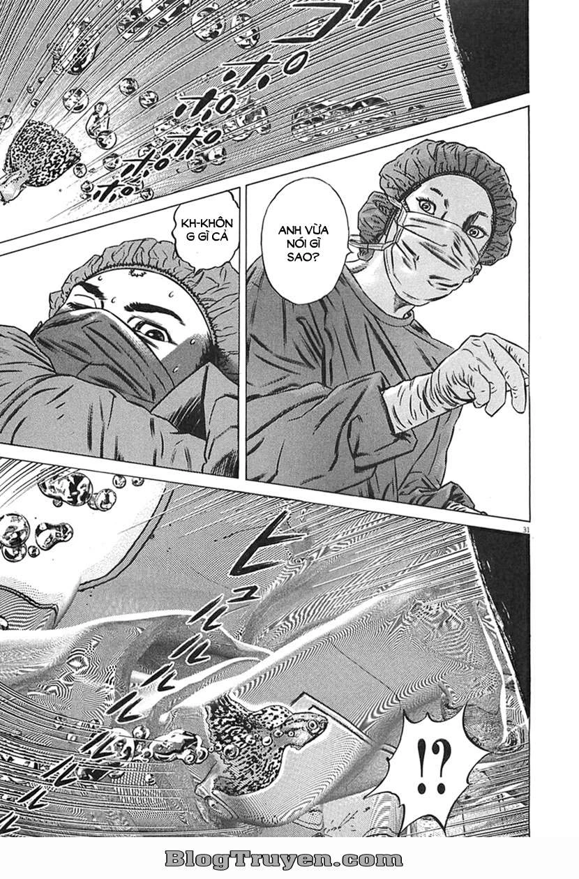 Homunculus Chapter 63 - 17