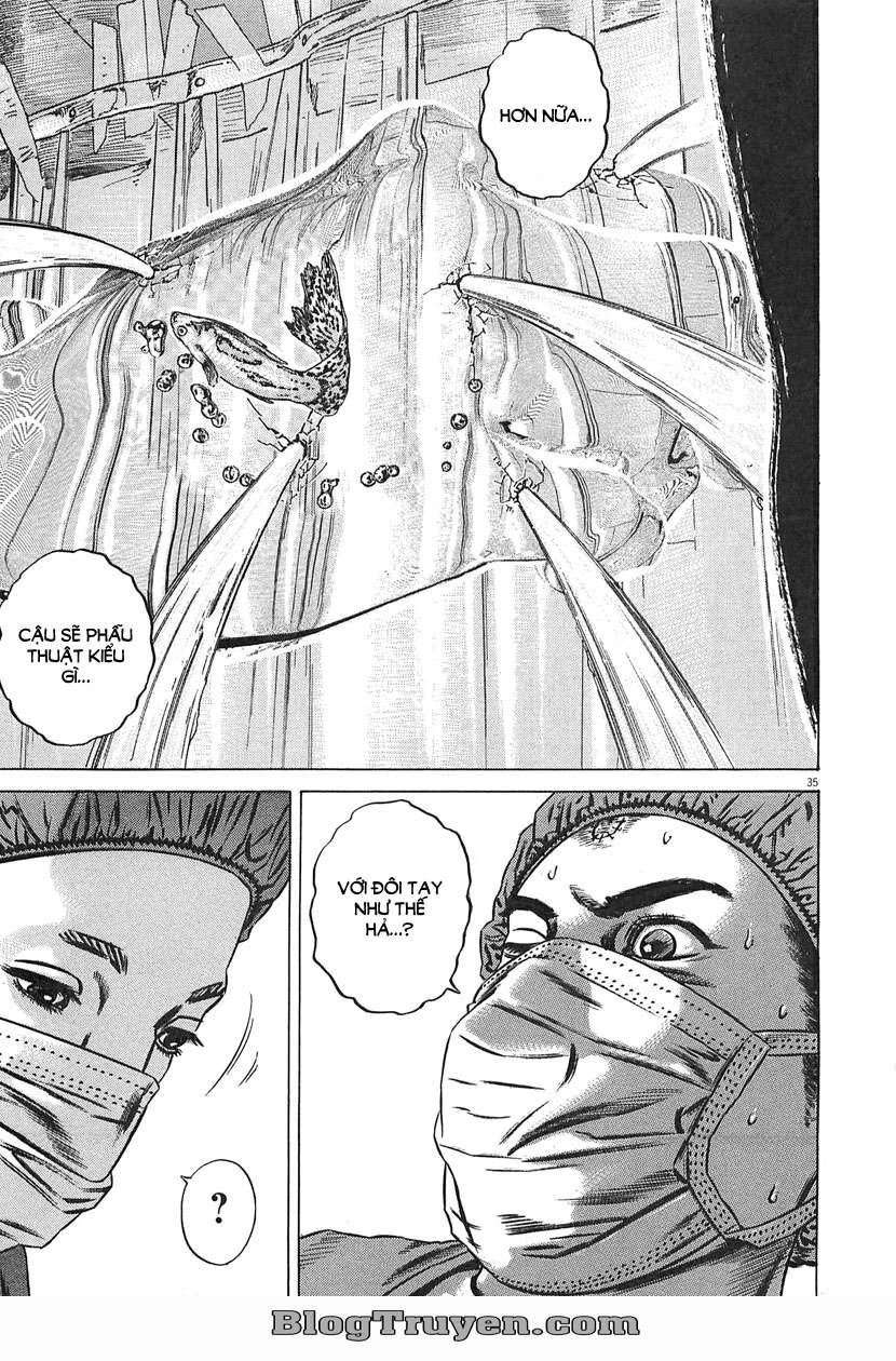 Homunculus Chapter 63 - 21