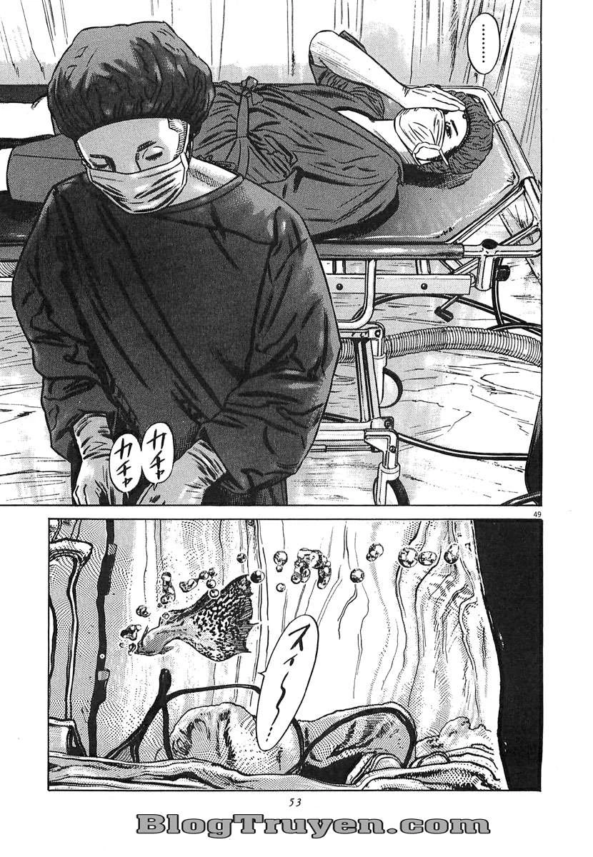 Homunculus Chapter 64 - 14