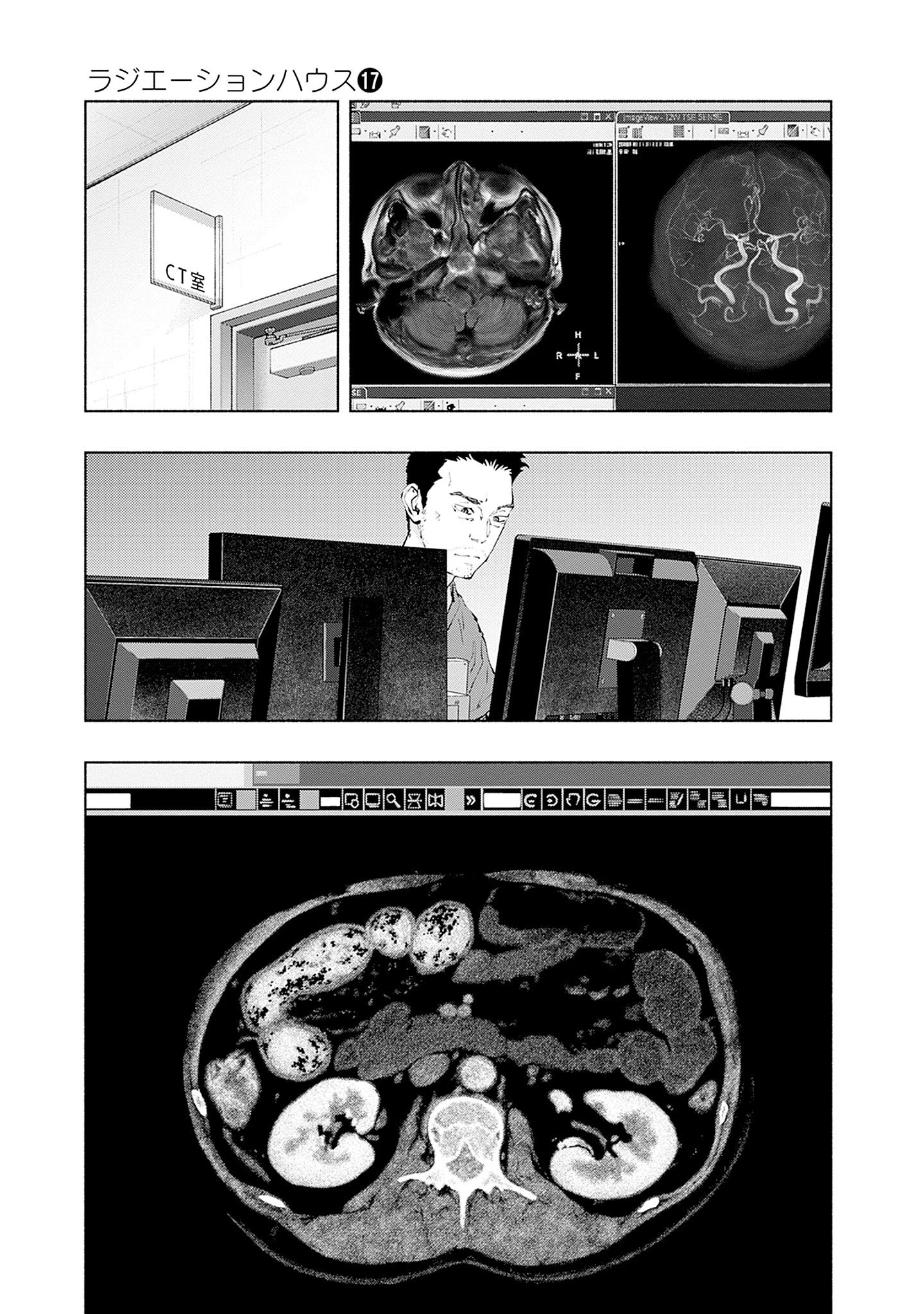 Radiation House Chapter 137 - 5