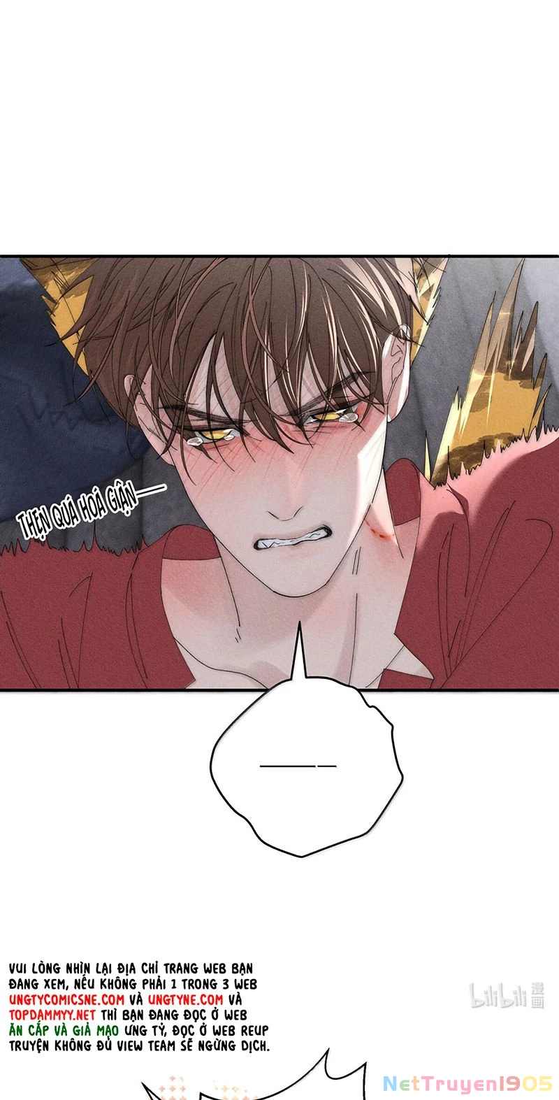 Ngày Nào Cũng Muốn Làm Vương Tủ Bệnh Kiều Phải Xấu Hổ Chapter 35 - 34